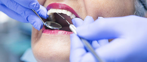 Best Emergency Dental Care for Sports Injuries in Louisa, VA